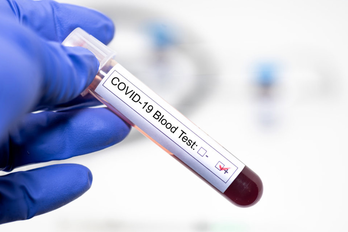 Newsroom3_ Covid-19 Screening Programme Blood Test results